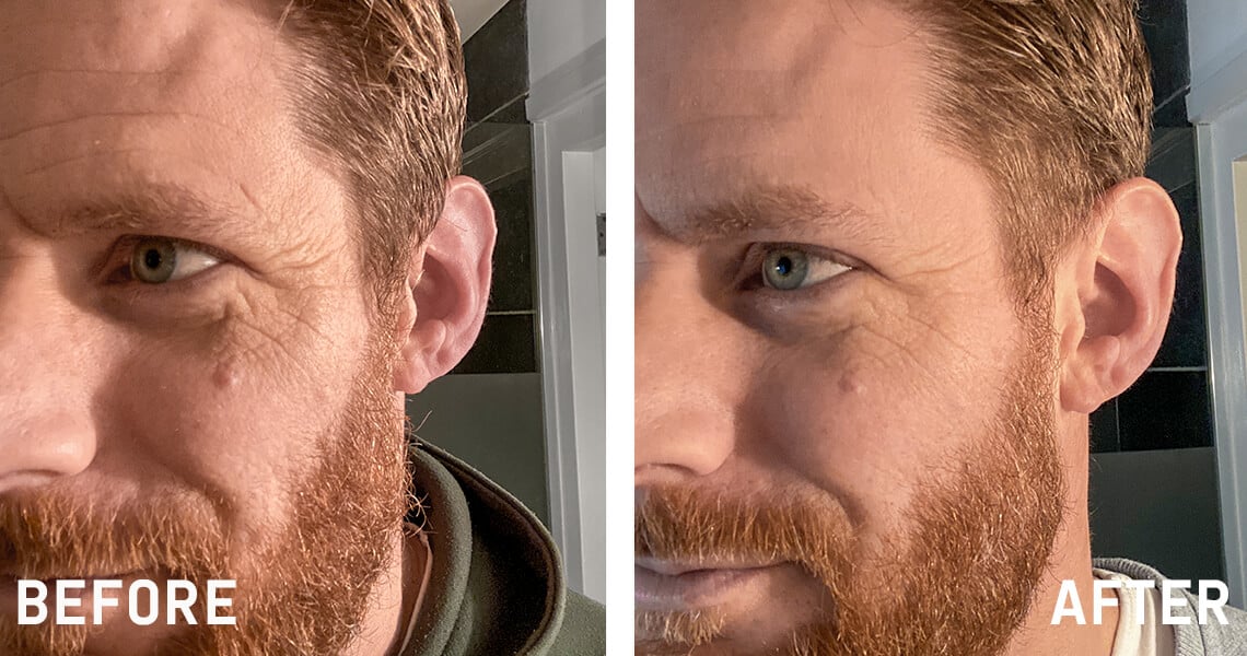 Jessiebeforeafter.png